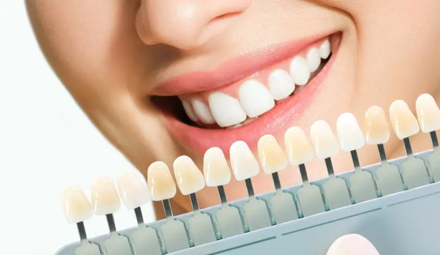 choosing color for Hollywood smile design