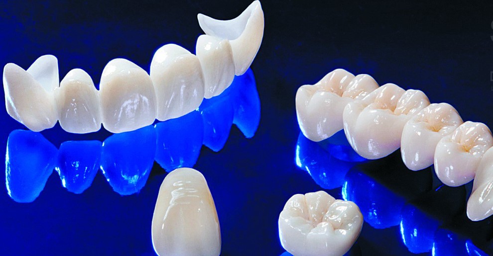 Zirconium Crowns