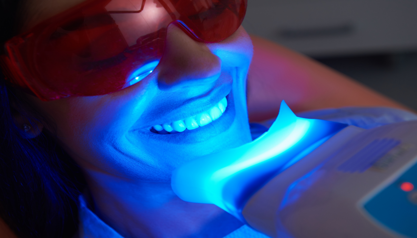 Laser teeth whitening