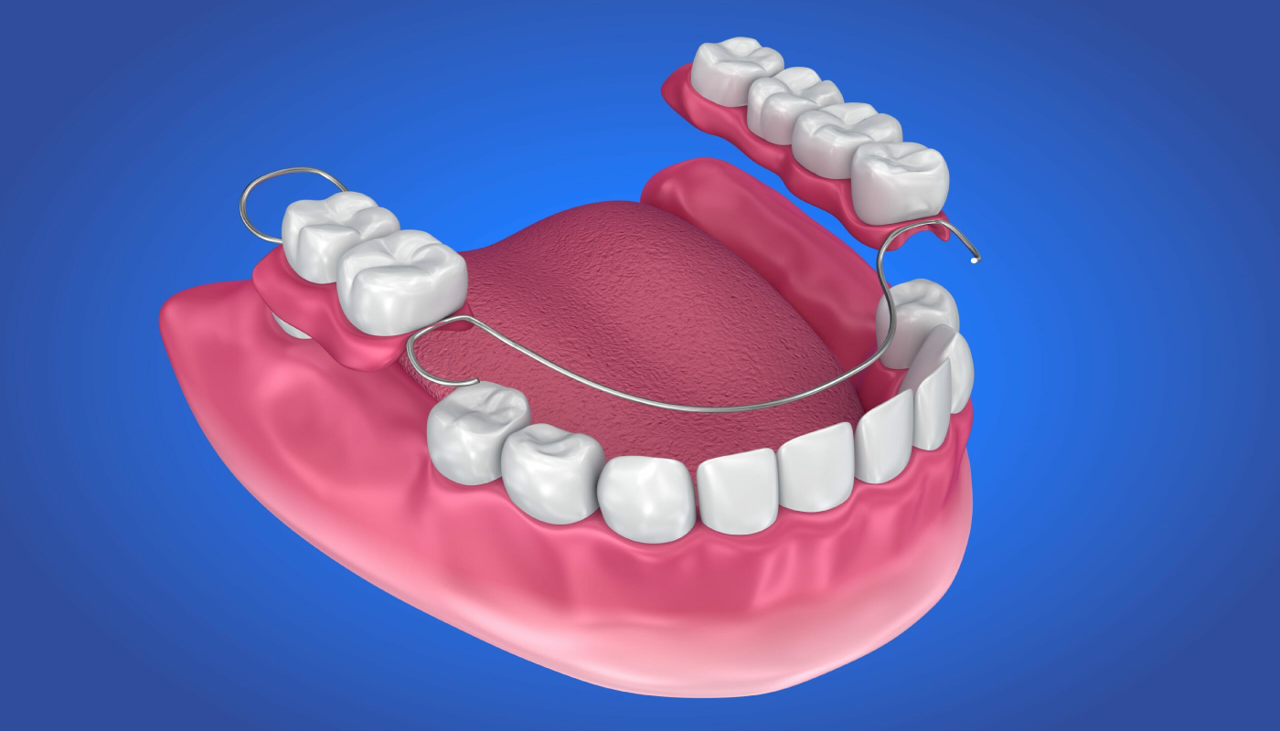 removable Dental Denture