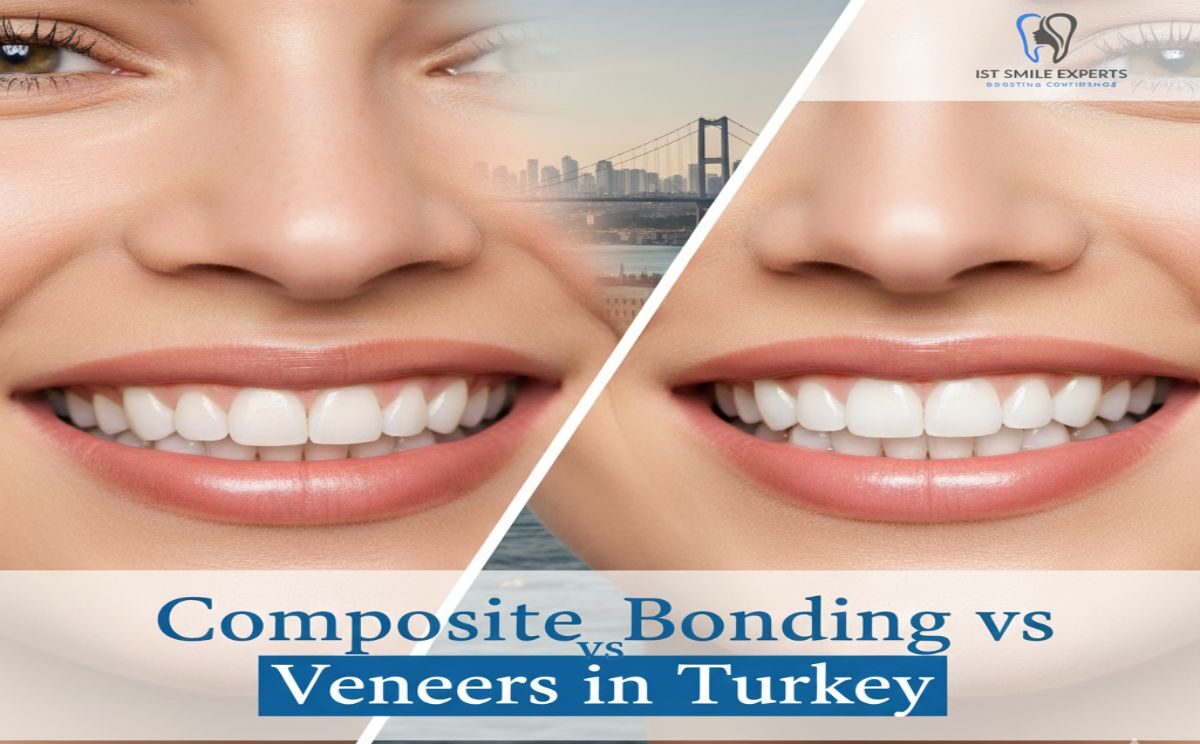A comparison image showing the beautiful results of composite bonding vs porcelain veneers in Turkey, with the IST Smile Experts logo.