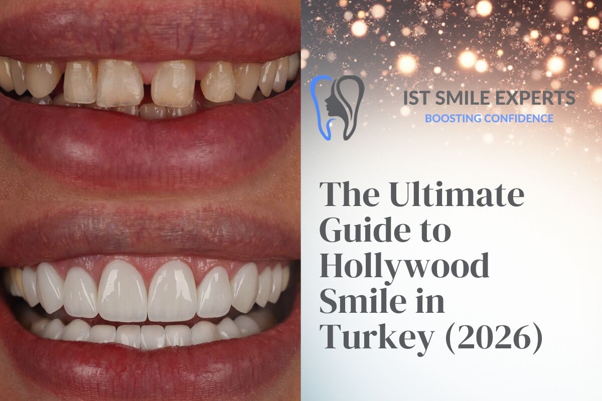 A before and after image of a Hollywood Smile makeover in Turkey, showing the final results from IST SMILE EXPERTS. This is the cover for 'The Ultimate Guide to Hollywood Smile in Turkey (2026)'.