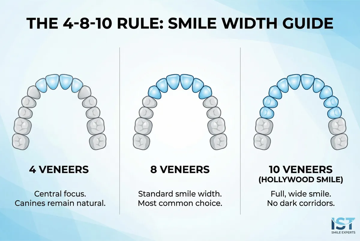 Infographic of the 4-8-10 Rule for dental veneers: Visualizing the smile width difference between 4 veneers, 8 veneers (standard), and 10 veneers (full Hollywood Smile to hide dark corridors) - IST SMILE EXPERTS