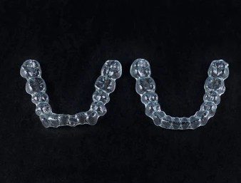 Before and after result of clear aligners showing straighter teeth and improved smile alignment at IST Smile Experts Istanbul
